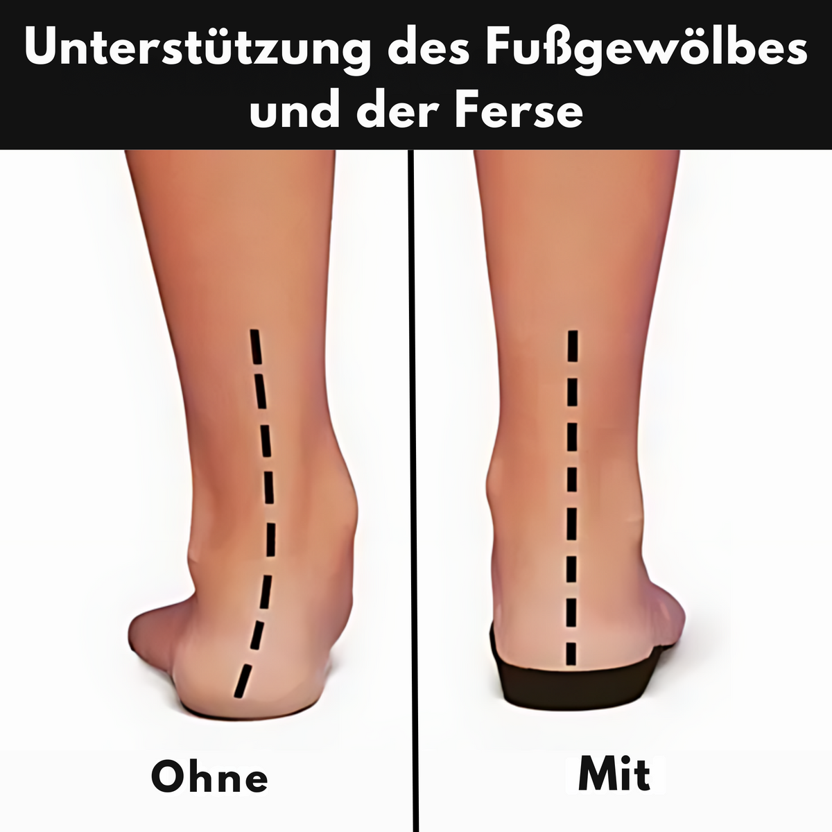 Fashion Glam | Orthopedic shoes for pain relief